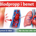 ultraljud blodpropp, ultraljud blodpropp undersökning, blodpropp i benet